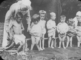 Tubercular children at Bettancourt.
