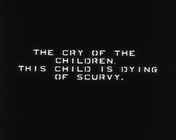 [THE CRY OF THE CHILDREN. THIS CHILD IS DYING OF SCURVY]